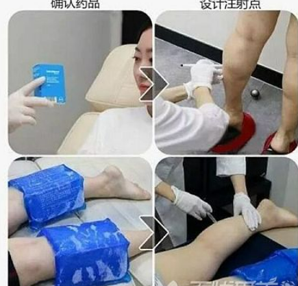 注射是什么？愛美小姑娘快看過來！