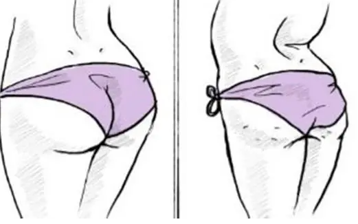 北京八大處整形醫(yī)院自體脂肪豐臀怎樣？真實(shí)案例分享~