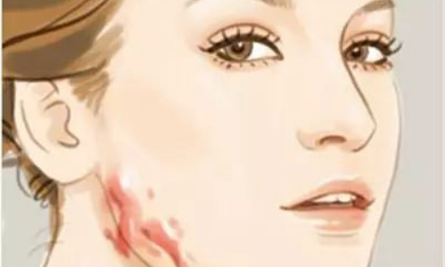 杭州時(shí)光整形醫(yī)院激光祛疤手術(shù)怎么樣？果好嗎內(nèi)附案例分享