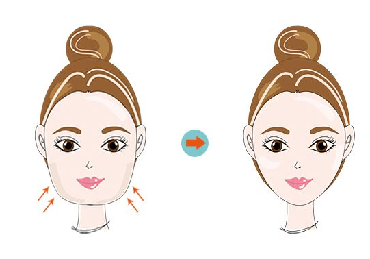 北京華韓醫(yī)療美容醫(yī)院面部吸脂案例分享，專業(yè)醫(yī)院值得信賴