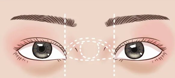 西安施爾綺整形醫(yī)院醫(yī)院技術(shù)怎么樣？真人案例反饋查看+醫(yī)院透明價(jià)格表