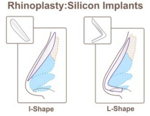 懷化市第一人民醫(yī)院整形美容外科膨體隆鼻靠譜嗎？醫(yī)院簡(jiǎn)介 、醫(yī)生介紹