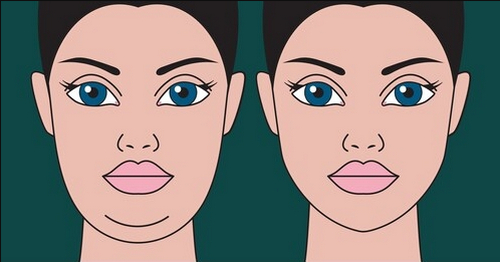 杭州浙一整形美容科吸脂效果好不好？簡介資料提前看，附上術后恢復案例