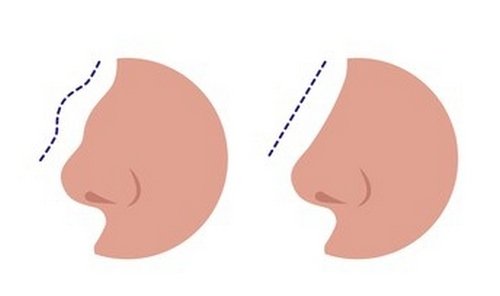 中山一院整形外科醫(yī)生哪個好？個個專業(yè)度高