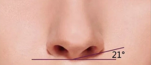 西安市人民醫(yī)院隆鼻修復(fù)費(fèi)用，醫(yī)院技術(shù)優(yōu)勢(shì)+案例參考