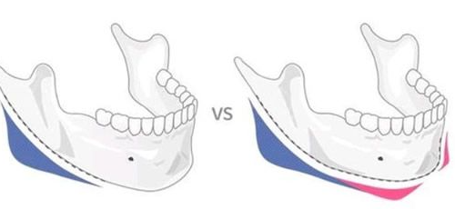 華西口腔醫(yī)院李繼華正頜怎么樣?收費貴不貴?資質(zhì)經(jīng)驗充足~