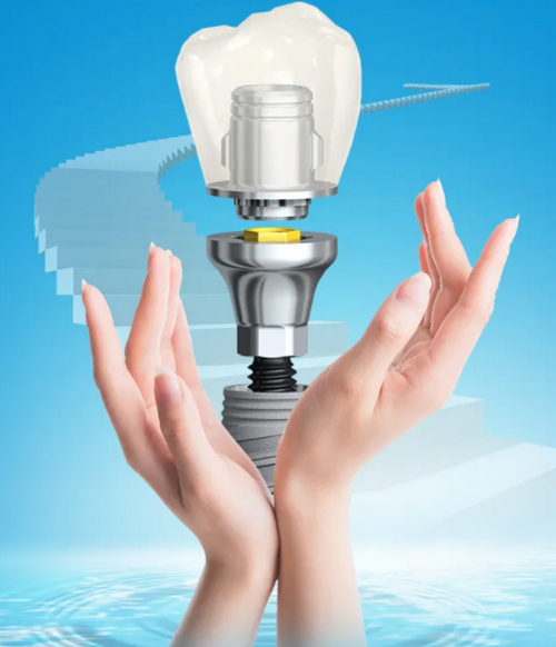 沈陽市第一人民醫(yī)院口腔科種植牙多少錢？牙齒種植經(jīng)驗(yàn)干貨看這里！