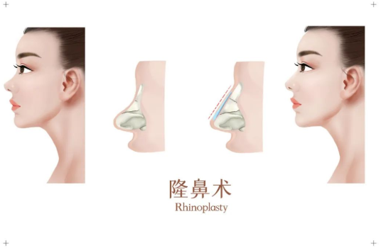 石家莊鼻部整形價(jià)格是多少?查看top3醫(yī)美機(jī)構(gòu)詳細(xì)資料