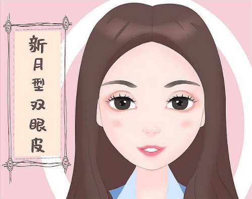 景德鎮(zhèn)市第一人民醫(yī)院美容整形外科做雙眼皮怎么樣?術(shù)前術(shù)后效果解析