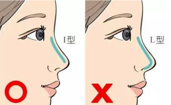 馬鞍山市人民醫(yī)院假體隆鼻技術(shù)價格怎么樣？全新價格表詳細(xì)參考