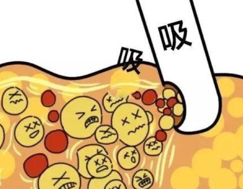 河北省中醫(yī)院美容科專家介紹,吸脂\雙眼皮等項(xiàng)目均有實(shí)力醫(yī)生