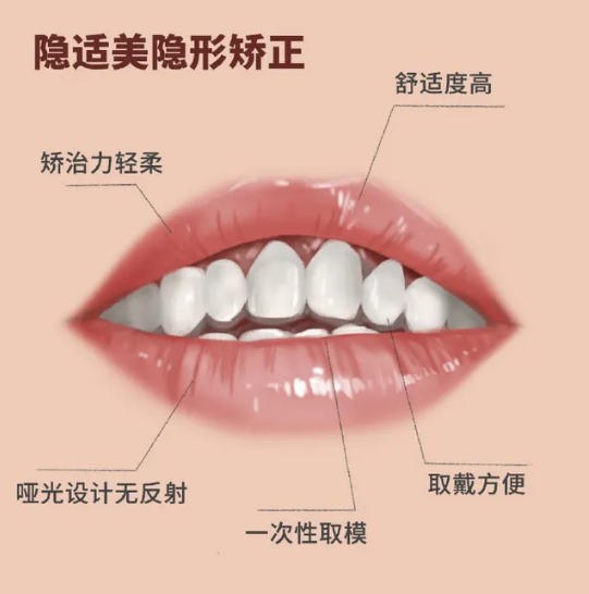 時代天使和隱適美哪個好？