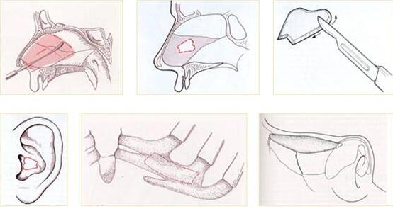義烏芙洛拉整形美容醫(yī)院怎么樣？價(jià)格表和醫(yī)院信息速來了解