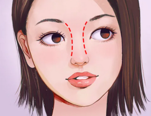 昆明市延安醫(yī)院整形美容外科隆鼻怎么樣?優(yōu)秀專家坐診打造美好容顏