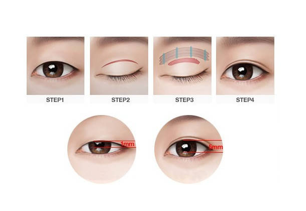 保定第一中心醫(yī)院美容科醫(yī)生名單上線,醫(yī)生資料/術(shù)后點評分享