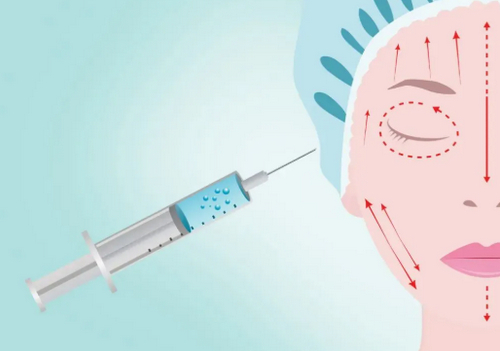 岳陽(yáng)愛(ài)思特整形美容醫(yī)院面部吸脂多少錢(qián)？恢復(fù)過(guò)程分享及醫(yī)院簡(jiǎn)介