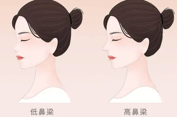 隆鼻怕術(shù)后恢復(fù)不好？護(hù)理知識一覽