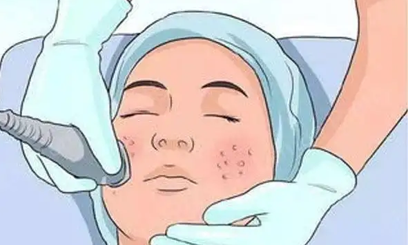 改良肌膚暗沉問題，激光嫩膚看一下~