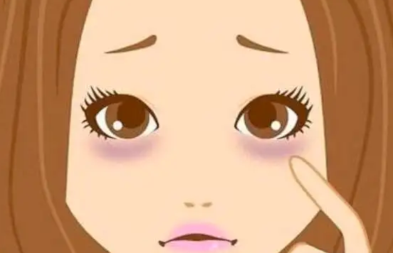 如何跟眼袋說拜拜，激光去眼袋了解一下！