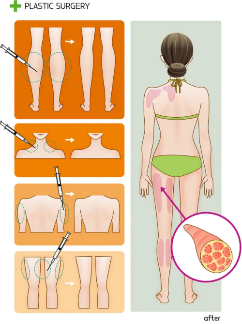 周口雅美醫(yī)療美容吸脂多少錢？醫(yī)院實力\術后效果全面點評