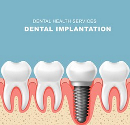 楚雄市第一人民醫(yī)院牙科收費標準，醫(yī)院醫(yī)生技術好不好