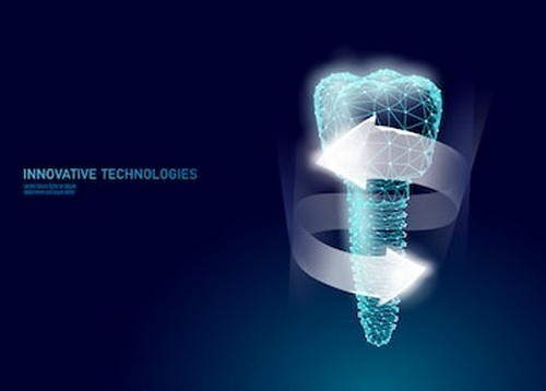 深圳美萊口腔種植牙怎么收費？專家詳情|種牙案例來了~