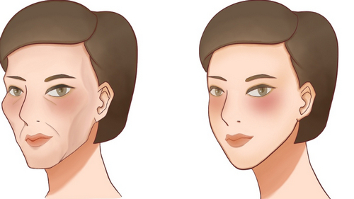 湘潭愛思特整形玻尿酸多少錢？案例效果及醫(yī)院介紹