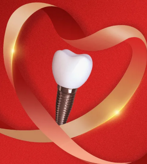 麗水市中心醫(yī)院口腔科種牙多少錢？重獲好牙沒煩惱