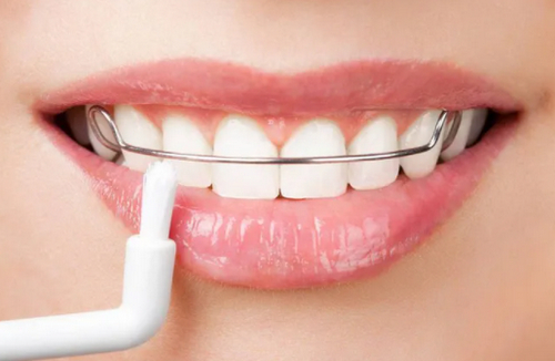 北京清華長(zhǎng)庚醫(yī)院口腔科正規(guī)嗎？新鮮價(jià)格表及技術(shù)詳情