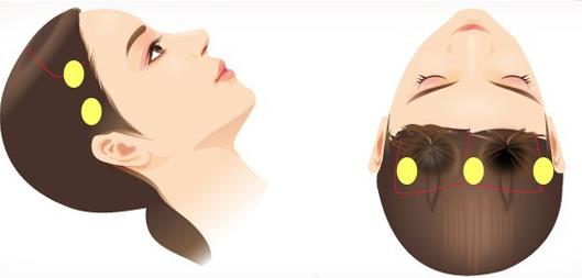 莫娜麗莎玻尿酸和伊婉哪個(gè)好