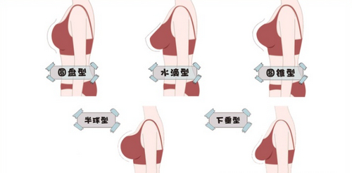 南京隆胸整形2024價格參考，哪家醫(yī)院比較合適？