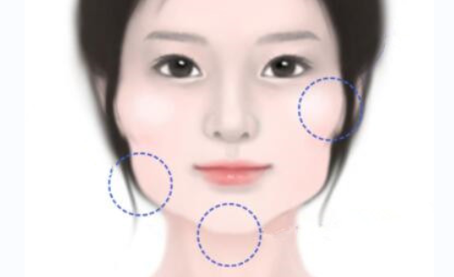 西安市中心醫(yī)院磨骨費用高嗎？科室實力&案例詳情分享