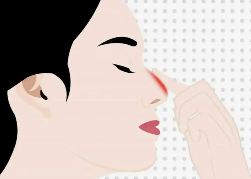 隆鼻的7個(gè)常見問題你知道多少，整形醫(yī)生為你解答