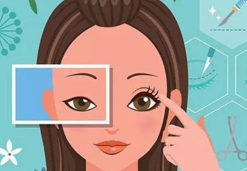 泉州雙眼皮價格多少錢？匯總前三醫(yī)院榜單