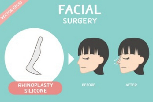 貴陽做鼻子大概多少錢?3家醫(yī)療機構(gòu)推薦