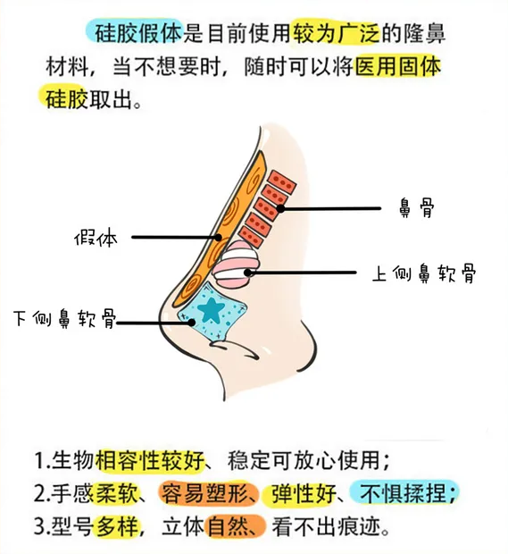 河北大學附屬醫(yī)院整形科膨體隆鼻怎么樣？整形案例分享