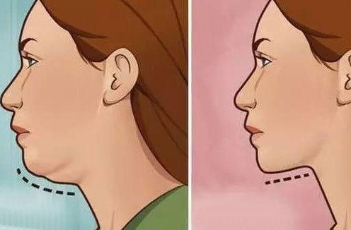 上海第九人民醫(yī)院整形下巴多少錢？科室概況、案例反饋