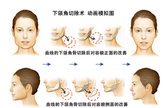 內(nèi)江市第一人民醫(yī)院整形美容外科頜面整形怎么樣？醫(yī)院簡介及優(yōu)勢亮同步參考
