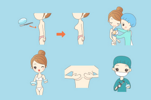 浙江大學(xué)醫(yī)學(xué)院附屬邵逸夫醫(yī)院整形科靠譜嗎？詳細(xì)價(jià)格表+醫(yī)院信息資料分析