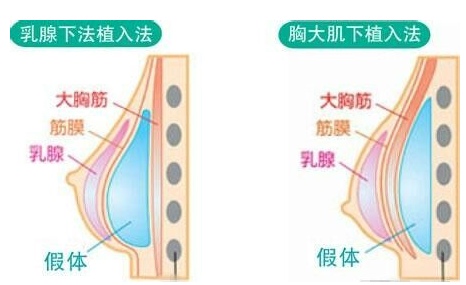 江西省皮膚病?？漆t(yī)院醫(yī)學(xué)美容假體隆胸好不好？醫(yī)院手術(shù)價(jià)格表+醫(yī)院介紹一覽