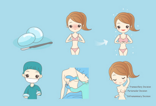 廣州隆胸整形2024收費表在線查看，幾家實力醫(yī)院信息一覽