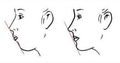 青島松山醫(yī)院整形科顴骨整形費(fèi)用價(jià)格多少？真人反饋怎么樣？