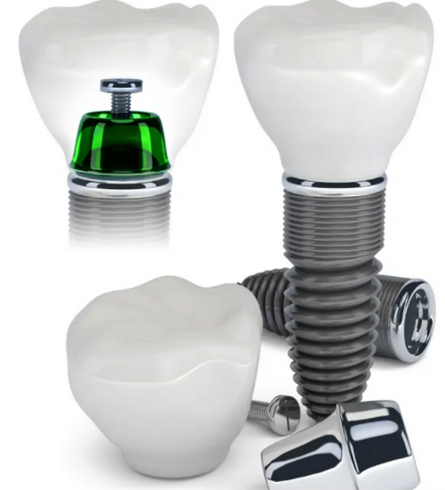 濰坊種牙齒一顆要多少錢?王凡濤、賀飛龍、侯國鎮(zhèn)均有上榜