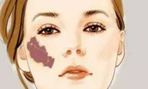 昆山市第一人民醫(yī)院燒傷整形外科燒傷修復(fù)正規(guī)嗎？口碑評(píng)價(jià)+案例