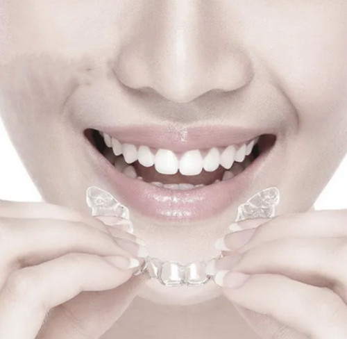 燕郊人民醫(yī)院口腔科怎么樣？牙齒矯正真人案例