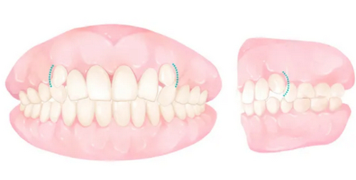 蘇州市第九人民醫(yī)院牙科牙齒矯正怎么樣？正畸過程詳細記錄|醫(yī)生信息