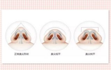 惠州中心醫(yī)院美容整形科膨體隆鼻怎么收費(fèi)？詳細(xì)科室詳情+醫(yī)生推薦