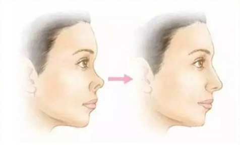 奉化市中醫(yī)院整形科正規(guī)嗎？醫(yī)院信息+技術(shù)優(yōu)勢查看