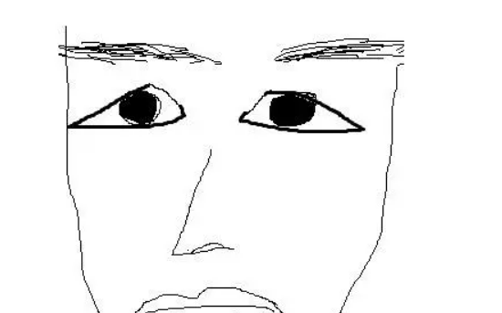 什么是三角眼，三角眼矯正相關(guān)問答等你瀏覽