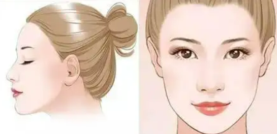 為何做輪廓手術(shù)時(shí)推薦四件套一起做？小編為大家解答